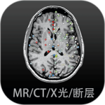 影像解剖图谱app官方正版下载 v4.5.8安卓版