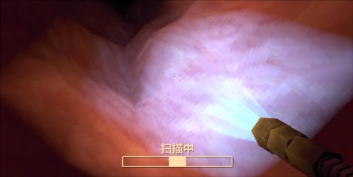 大肠的复仇(Revenge Of The Colon) 大肠的复仇