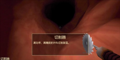 大肠的复仇(Revenge Of The Colon) 大肠的复仇